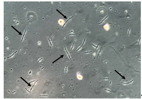 rare yeast in urine