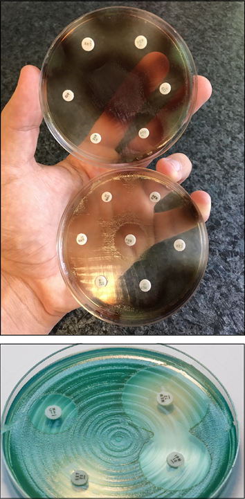 pseudomonas aeruginosa culture