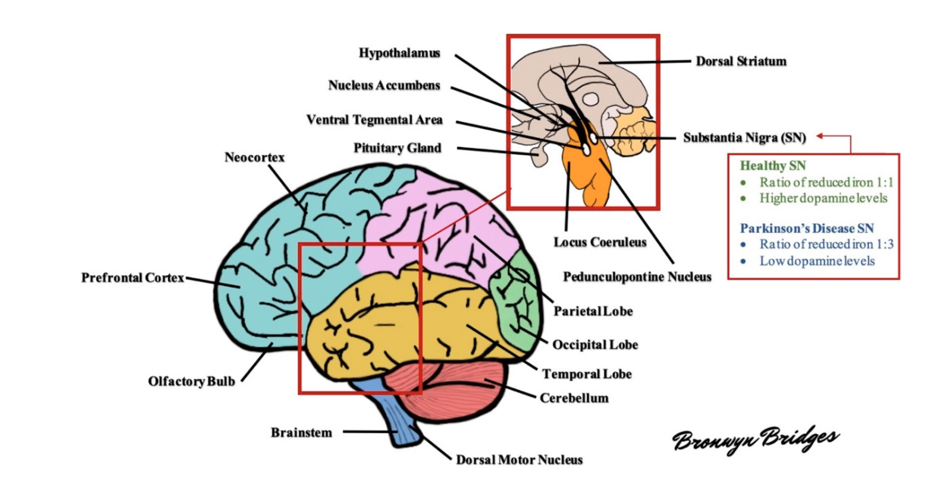 Figure 1. Schematic diagram of the human brain. Several areas of the brain are adversely affected in Parkinson’s disease (PD). For example, the substantia nigra exhibits a profound loss of dopaminergic Figure 1. Schematic diagram of the human brain. Several areas of the brain are adversely affected in neurons and altered levels of reduced iron, likely as a result of increased oxidative stress. As the disease Parkinson’s disease (PD). For example, the substantia nigra exhibits a profound loss of dopaminergic progresses, other areas of the brain develop lesions, including the dorsal motor nucleus, neocortex, neurons and altered levels of reduced iron, likely as a result of increased oxidative stress. As the prefrontal cortex, locus coeruleus, amygdala, and more (see text for further details)