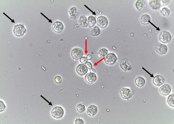 rare yeast in urine