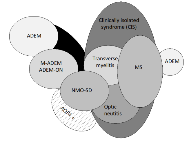 Acute Disseminated Encephalomyelitis Encyclopedia