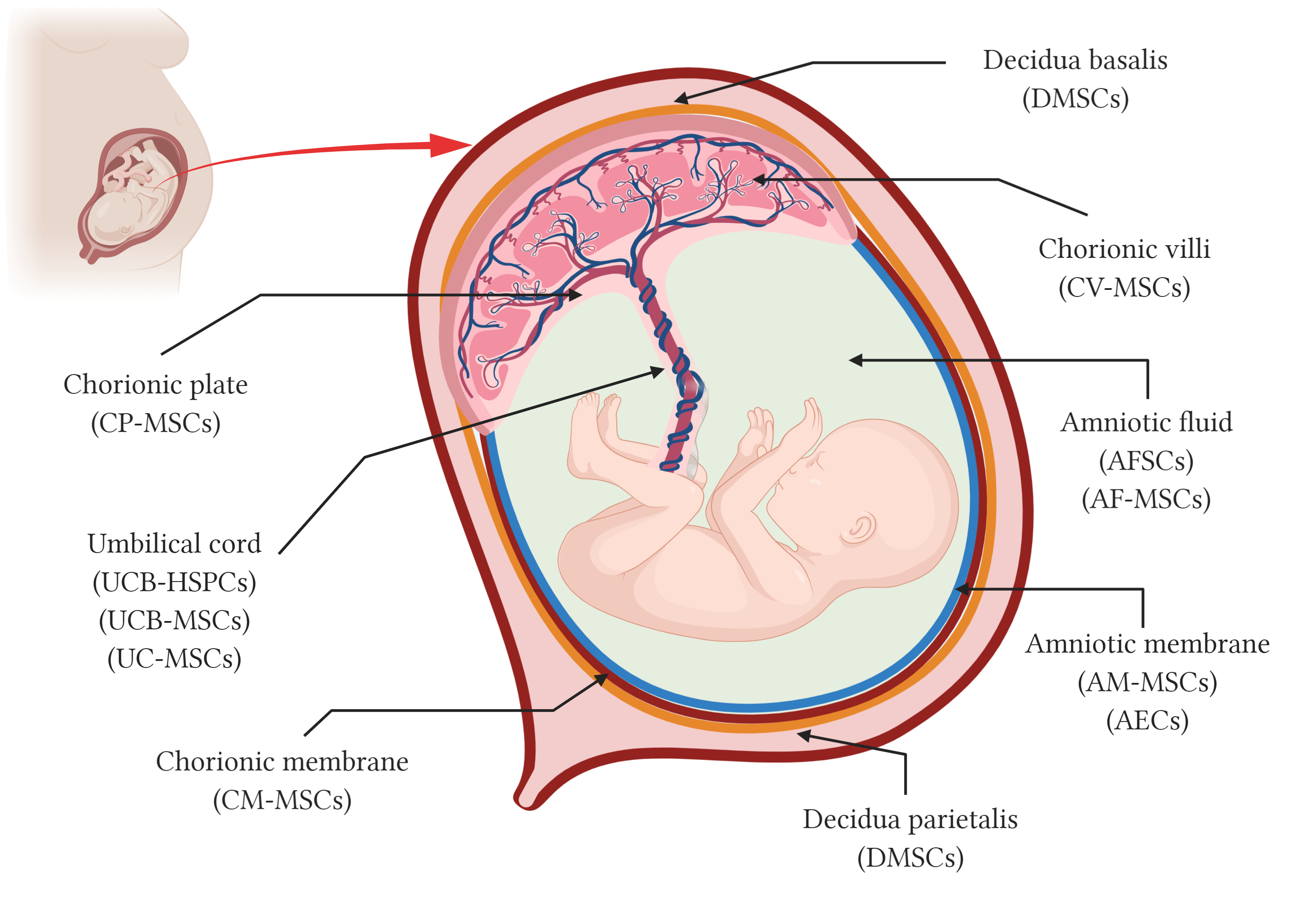 Figure 1. Schematic representation of perinatal tissues and perinatal stem cells. Anatomy of the human term placenta and its fetal annexes representing the main regions from which different types of perinatal stem cells have been isolated. AMSCs, amniotic membrane mesenchymal stromal cells; AEC, amniotic membrane epithelial cells; CMSCs, chorionic membrane mesen-chymal stromal cells; CP-MSCs, chorionic plate mesenchymal stem cells; CV-MSCs, chorionic villi mesenchymal stromal cells; AFC, amniotic fluid cells; AFSC, amniotic fluid stem cells; AF-MSC, amniotic fluid mesenchymal stromal cells; UCB-HSPC, umbilical cord blood hematopoietic stem/progenitor cells; UCB-MSC, umbilical cord blood mesenchymal stromal cells; UC-MSCs, umbilical cord mesenchymal stromal cells; and DMSC, decidua-derived mesenchymal stromal cells. Created with BioRender.com.