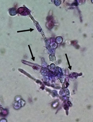 rare yeast in urine